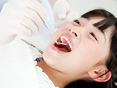乳歯が虫歯になりやすいというのは本当ですか？