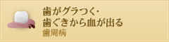 歯がグラつく・歯ぐきから血が出る 歯周病