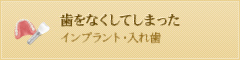 歯をなくしてしまった インプラント・入れ歯